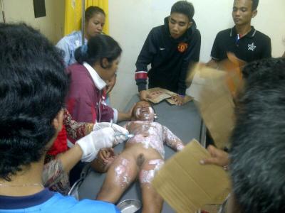 Malang Nasib Hidayatullah Mau Hidupkan Pelita Tubuhnya Dilalap Api